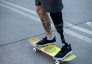 Tutti ridevano del figlio del milionario, chiamandolo “robot”, e solo una ragazza di colore ebbe il coraggio di difenderlo e diventare sua amica.