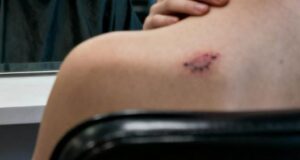 Un rituale notturno ripetuto per 35 anni rivela un dolore nascosto, un segreto straziante e una verità sconvolgente finalmente svelata. Nascondeva un corpo in rovina... e la sofferenza che aveva sopportato in solitudine per decenni. E il segreto rivelato è stato un vero shock per tutti.