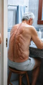 Un rituale notturno ripetuto per 35 anni rivela un dolore nascosto, un segreto straziante e una verità sconvolgente finalmente svelata. Nascondeva un corpo in rovina... e la sofferenza che aveva sopportato in solitudine per decenni. E il segreto rivelato è stato un vero shock per tutti.